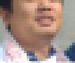 40209 B
